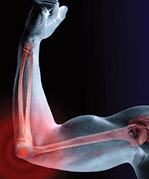 Kératine: Protection antioxydante et soutien pour la réparation des articulations