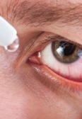 Zaskakujące przyczyny zespołu suchego oka