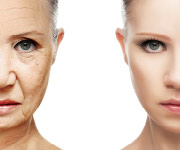 Reduce Wrinkles in Eight Weeks