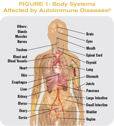 Autoummine Disease