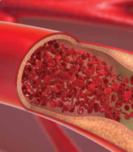 Endothelial Dysfunction and Cardiovascular Disease